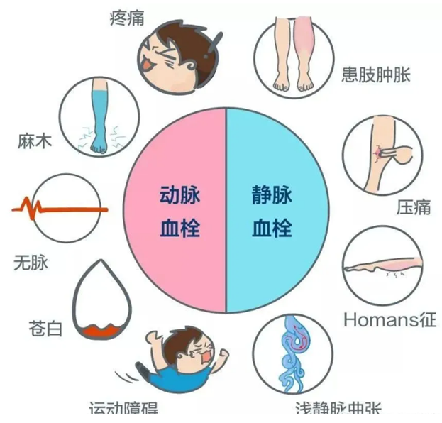 2022世界血栓日：就医有新路，血栓找介入