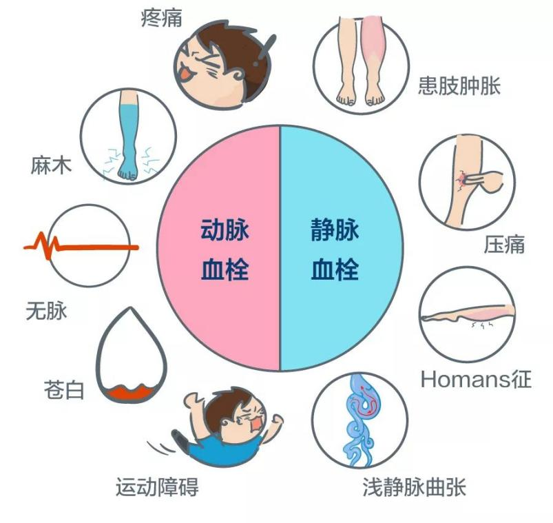 深静脉血栓能致命，防治“大法”要了解！